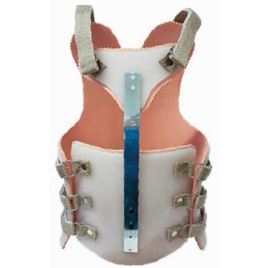 Corset TLSO con control Esternal